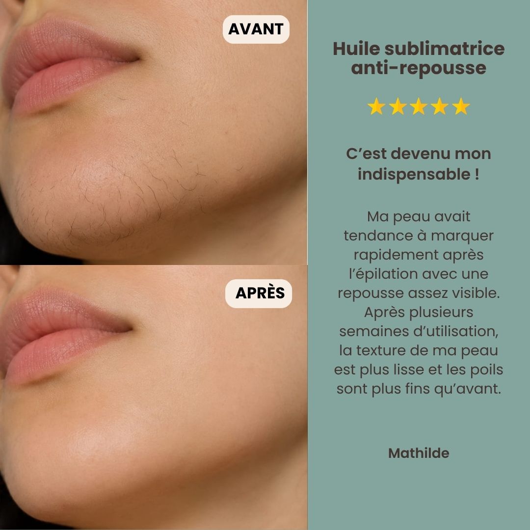 L'Huile de Cyperus Rotundus Précieuse | Une Peau Lisse et Repousse Ralentie