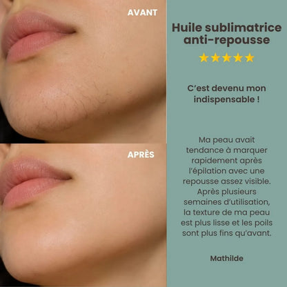 L'Huile de Cyperus Rotundus  Précieuse | Une Peau Satinée et Repousse Ralentie