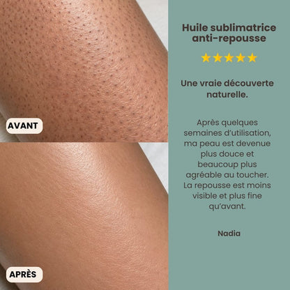 L'Huile de Cyperus Rotundus Précieuse | Une Peau Lisse et Repousse Ralentie