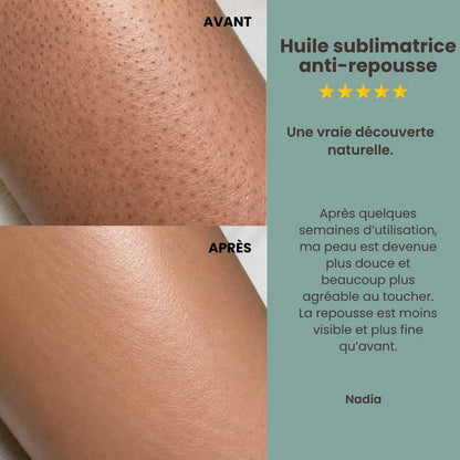 L'Huile de Cyperus Rotundus  Précieuse | Une Peau Satinée et Repousse Ralentie